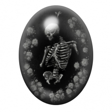 Cabochon en Verre Illustré Squelette Fleurs Gothique 13x18, 18x25 ou 30x40mm  pour la Création de Bijoux Fantaisie - DIY
