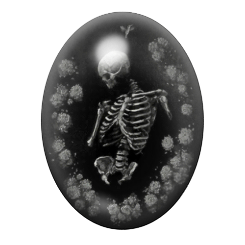 Cabochon en Verre Illustré Squelette Fleurs Gothique 13x18, 18x25 ou 30x40mm